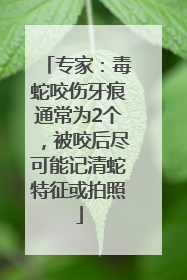 专家：毒蛇咬伤牙痕通常为2个，被咬后尽可能记清蛇特征或拍照